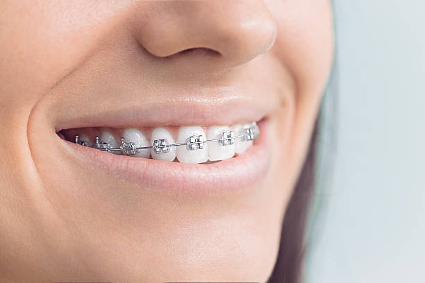 Best Dental Fillings (Composite and Amalgam)  in Sheffield, AL